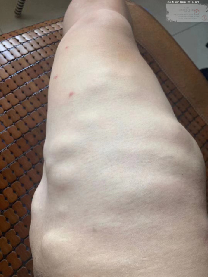 四肢局部参考